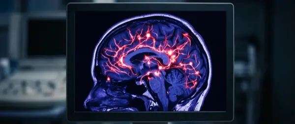 Brain Network Behind Parkinson