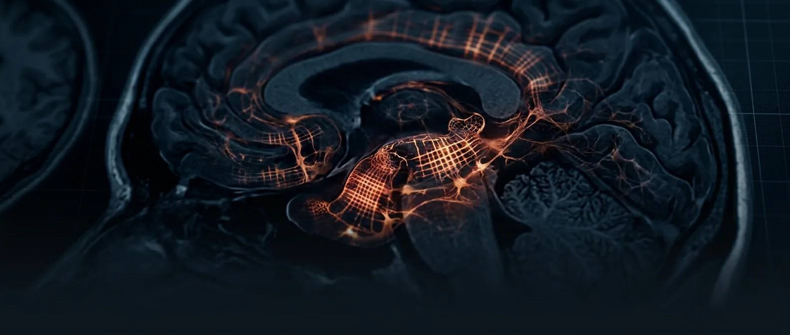 Brain scan showing cortisol's impact on spatial navigation and grid cells in the entorhinal cortex